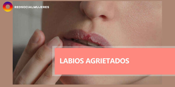 ¿Cómo dejar de tener los labios secos y agrietados?