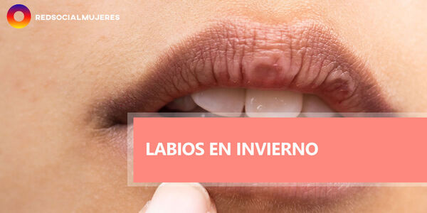 Consejos para el cuidado de los labios en invierno