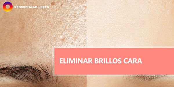 Remedios naturales para eliminar los brillos en la cara