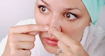 ¿Cómo quitar los poros tapados de la nariz o comedones?