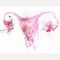 Vivir con Endometriosis 